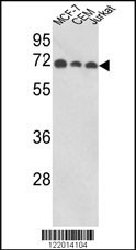 ABI1 Antibody