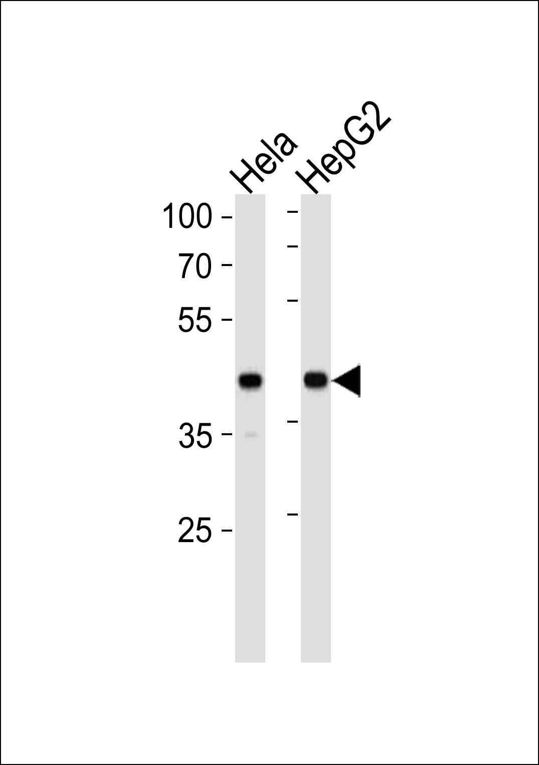 LRPAP1 Antibody