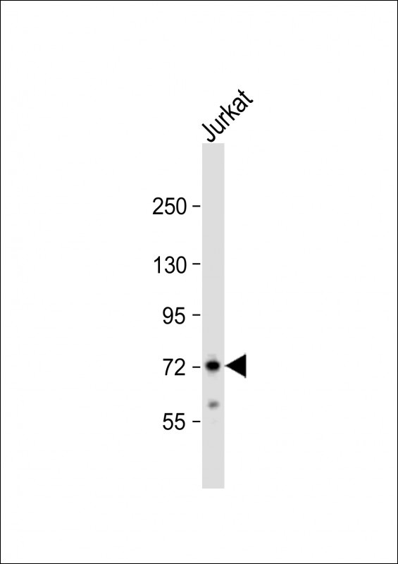 ZFP36 Antibody