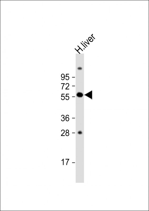 SLC11A1 Antibody