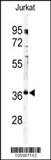 PPP6C Antibody