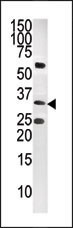 CTDSP1-V250 Antibody