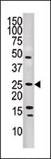 DUSP13-L184 Antibody