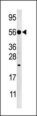 DUSP8 Antibody