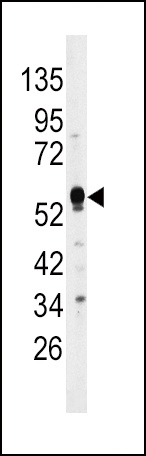 DUSP4 Antibody