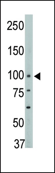 PTPN3 Antibody