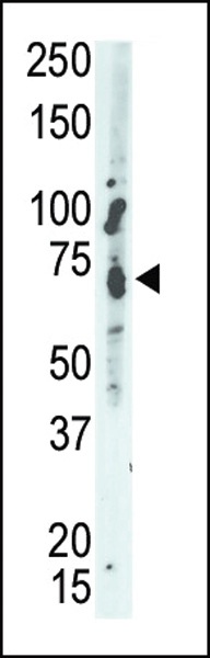 PTPN9 Antibody