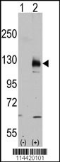 TRPM8 Antibody