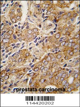 TRPM8 Antibody