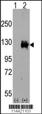 TRPM8 Antibody