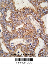 TRPM8 Antibody
