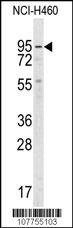 Guanylyl Cyclase alpha 2 Antibody