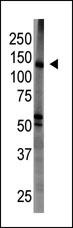 BAIAP1 Antibody