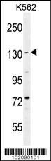 BAI1 Antibody