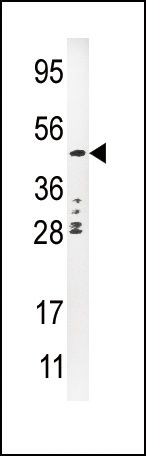 Urokinase Antibody