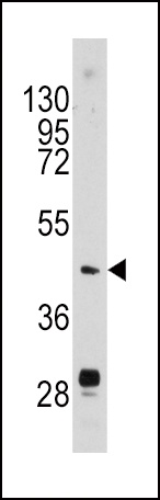 Urokinase Antibody