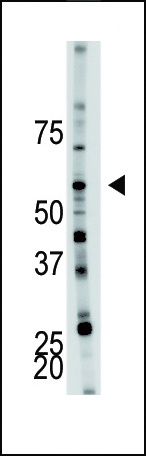 PFKFB4 Antibody