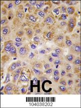 PFKFB1 Antibody