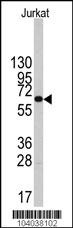PFKFB1 Antibody
