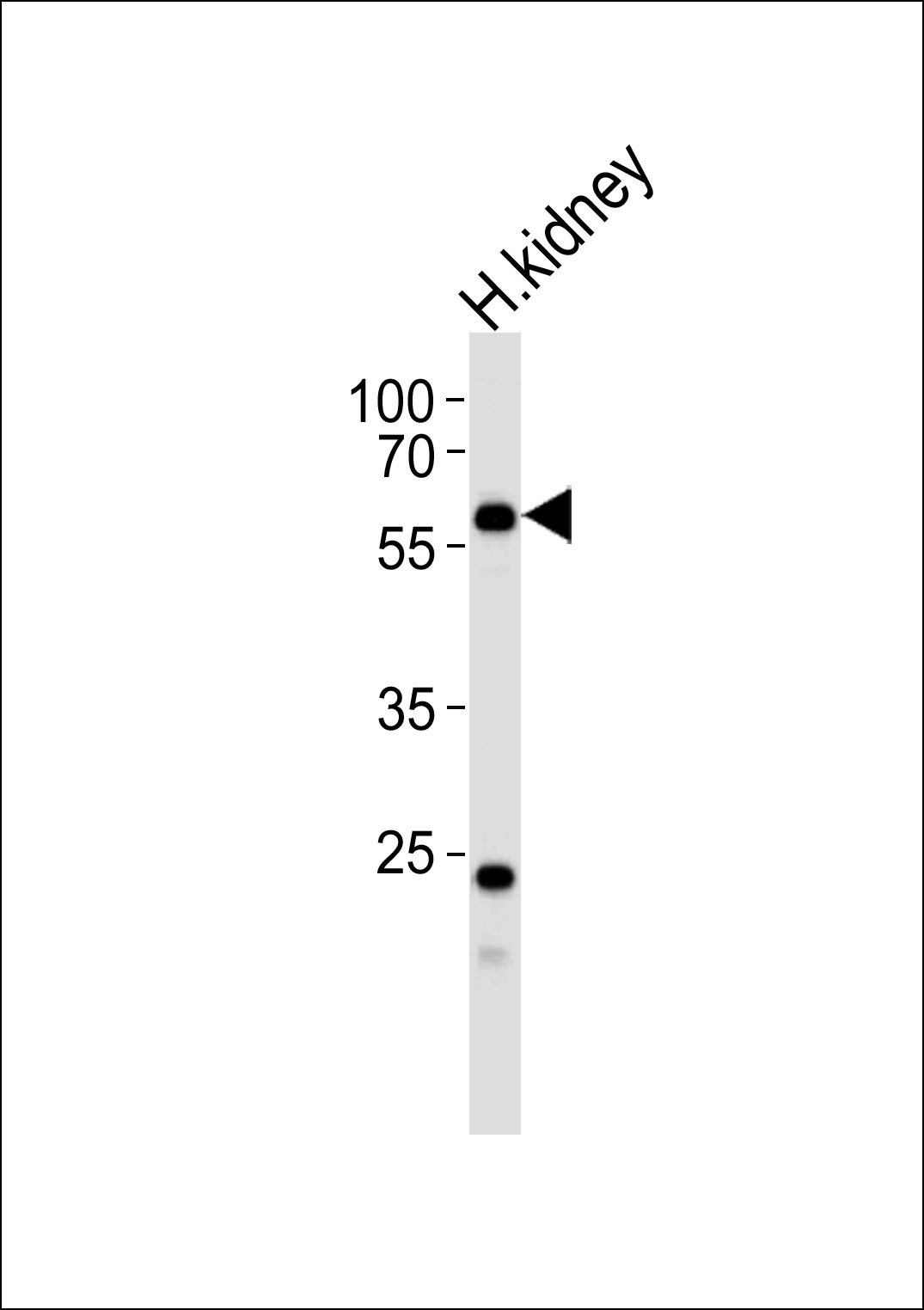 PFKFB3 Antibody