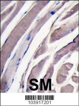 HK2 Antibody