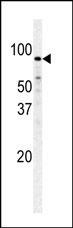 PFKM Antibody