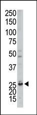 AK3 Antibody