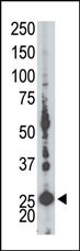 AK5 Antibody