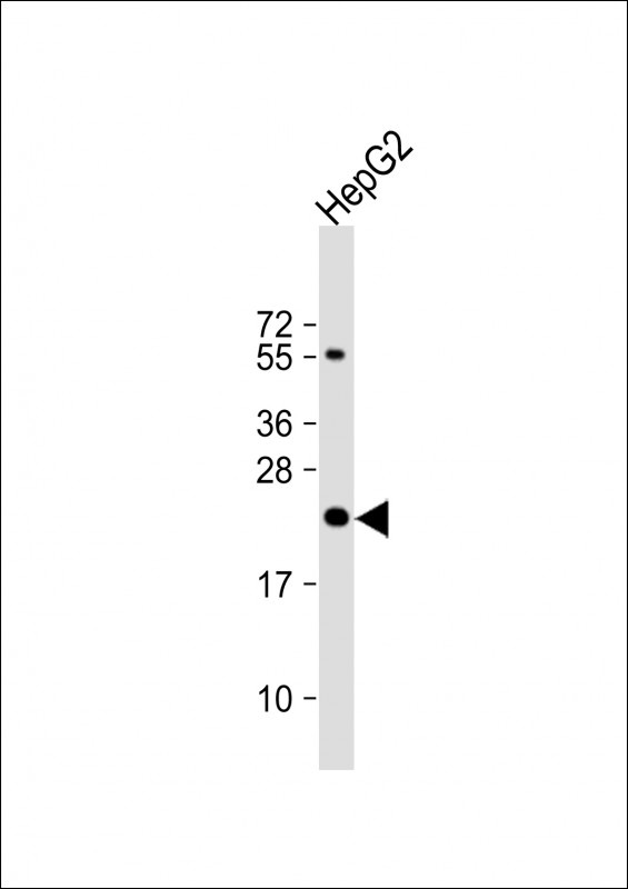 UCK Antibody