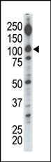Diacylglycerol kinase iota Antibody