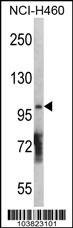 DGKQ Antibody