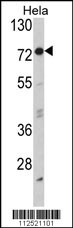 EIF2AK1 Antibody
