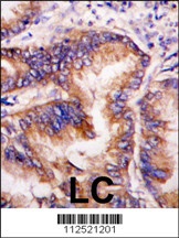 EIF2AK1 Antibody