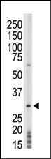 TP53RK Antibody