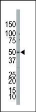 PIP5K2B Antibody