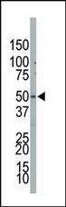 PIP4K2B Antibody