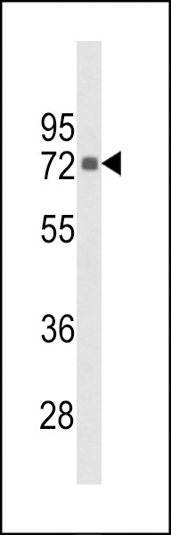 PIP5KI gamma Antibody