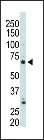 PIP5KI gamma Antibody