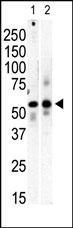 PI 4 Kinase type 2 beta antibody