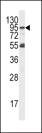 PIK3R5 Antibody