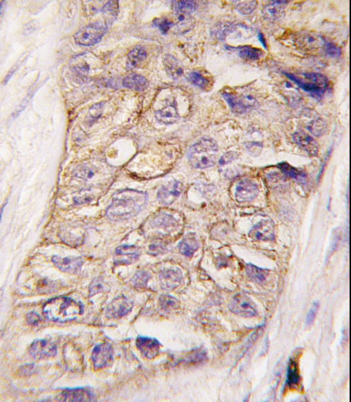 PI3KC2B Antibody