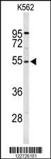 RPS6KB2 Antibody