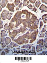 MAP3K13 Antibody