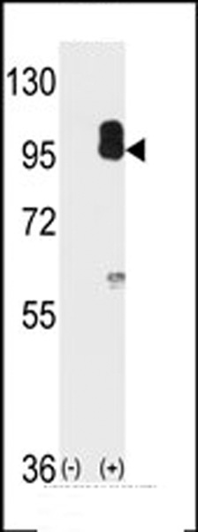 cGKII Antibody