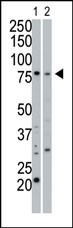 PRKG1 Antibody