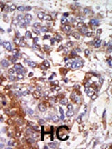 PRKG1 Antibody