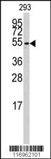 CYP26B1 Antibody
