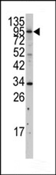 MYLK3 Antibody