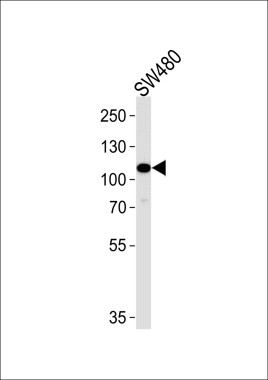 MAP3K9 Antibody