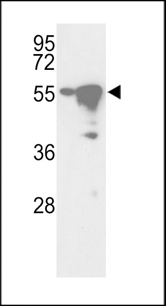 STK25 Antibody